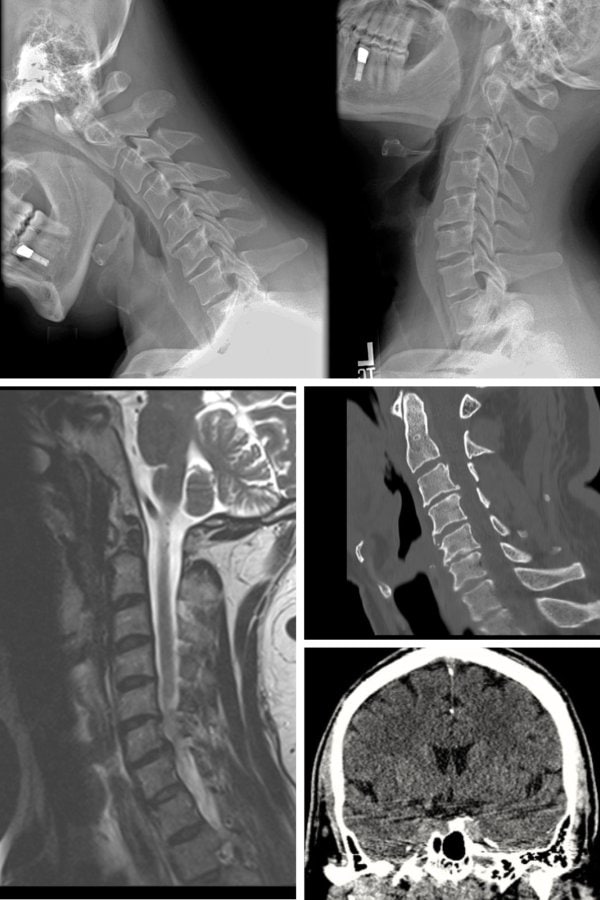 accurate diagnostics for auto injuries - Eatontown NJ