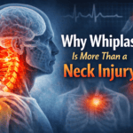 Medical illustration showing whiplash injury affecting the cervical spine, brain, and upper body, demonstrating that whiplash involves neurological and whole-body effects beyond neck pain.